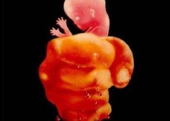 भ्रूण हत्या: अखिलेश श्रीवास्तव की कविता