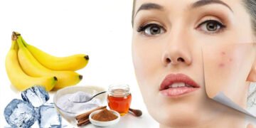 मुहांसों से निजात पाने के चार आसान से घरेलू तरीक़े