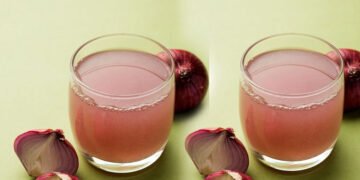 प्याज़ का रस सुधारेगा बालों की सेहत