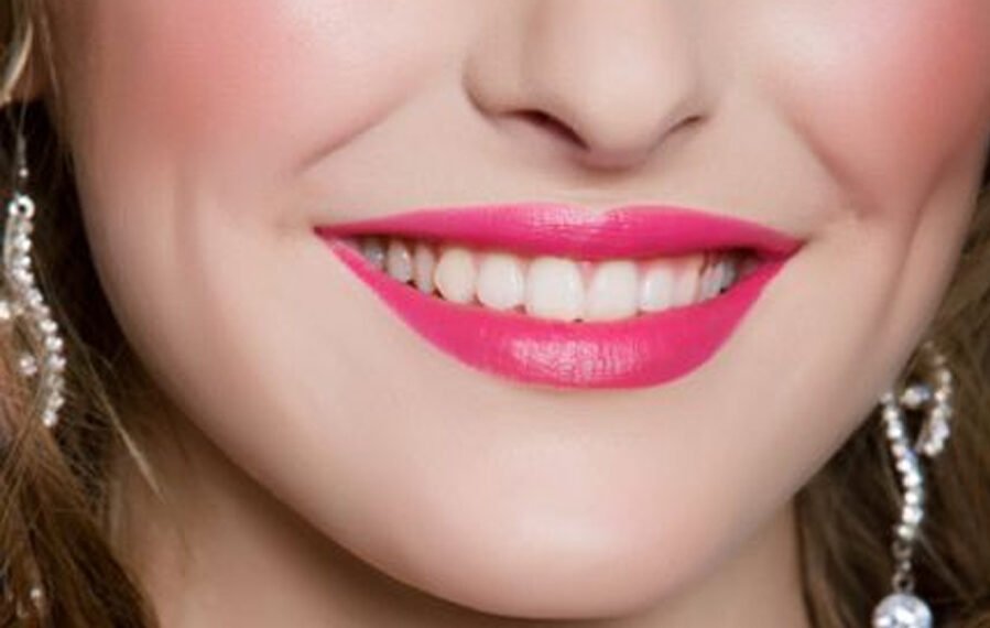 मोतियों जैसे सफ़ेद दांत पाने के कुछ आसान तरीक़े