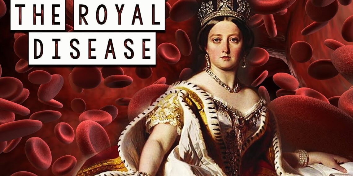 Hemophilia_Royal-Disease